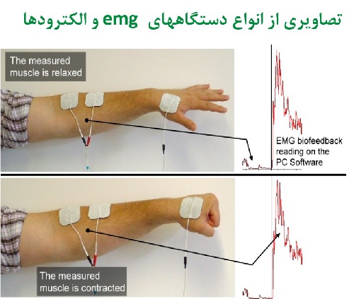  پاورپوینت ELECTROMYOGRAPHY الکترومیوگرافی